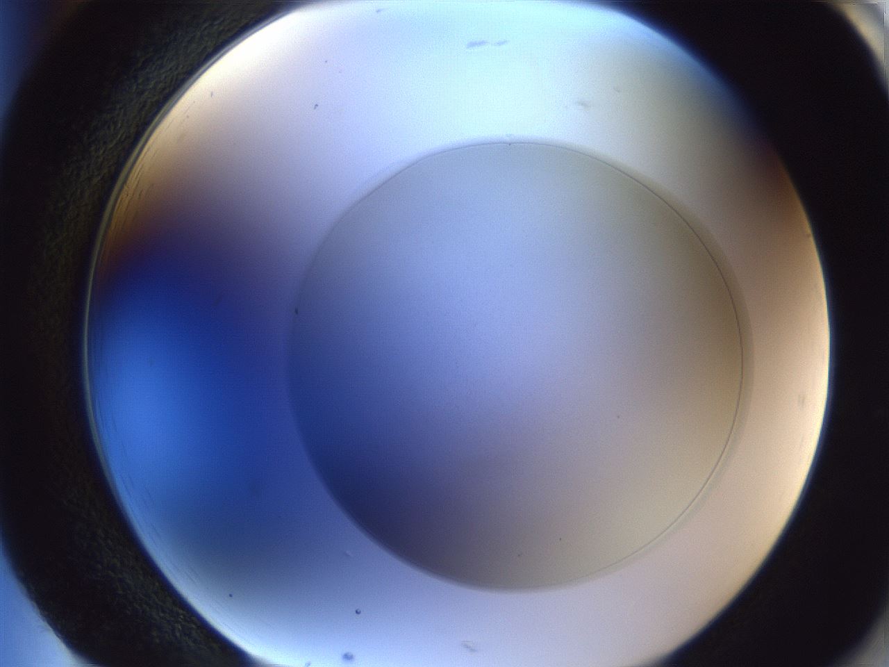 folderID28_plateID1028_batchID1980_wellNum85_profileID1_d2_r44109_ef.jpg