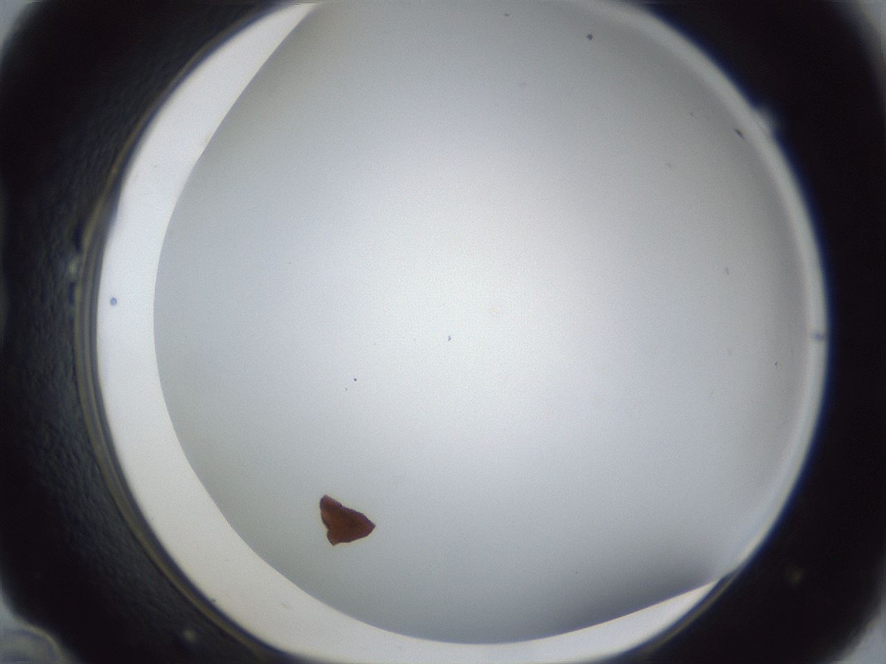 folderID28_plateID1028_batchID1993_wellNum22_profileID1_d1_r43982_ef.jpg
