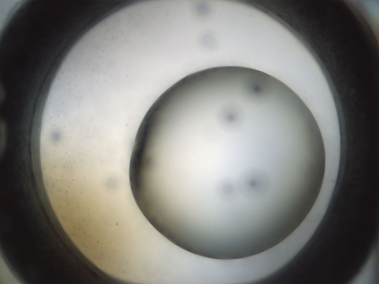 folderID298_plateID1298_batchID4261_wellNum74_profileID1_d1_r78273_ef.jpg