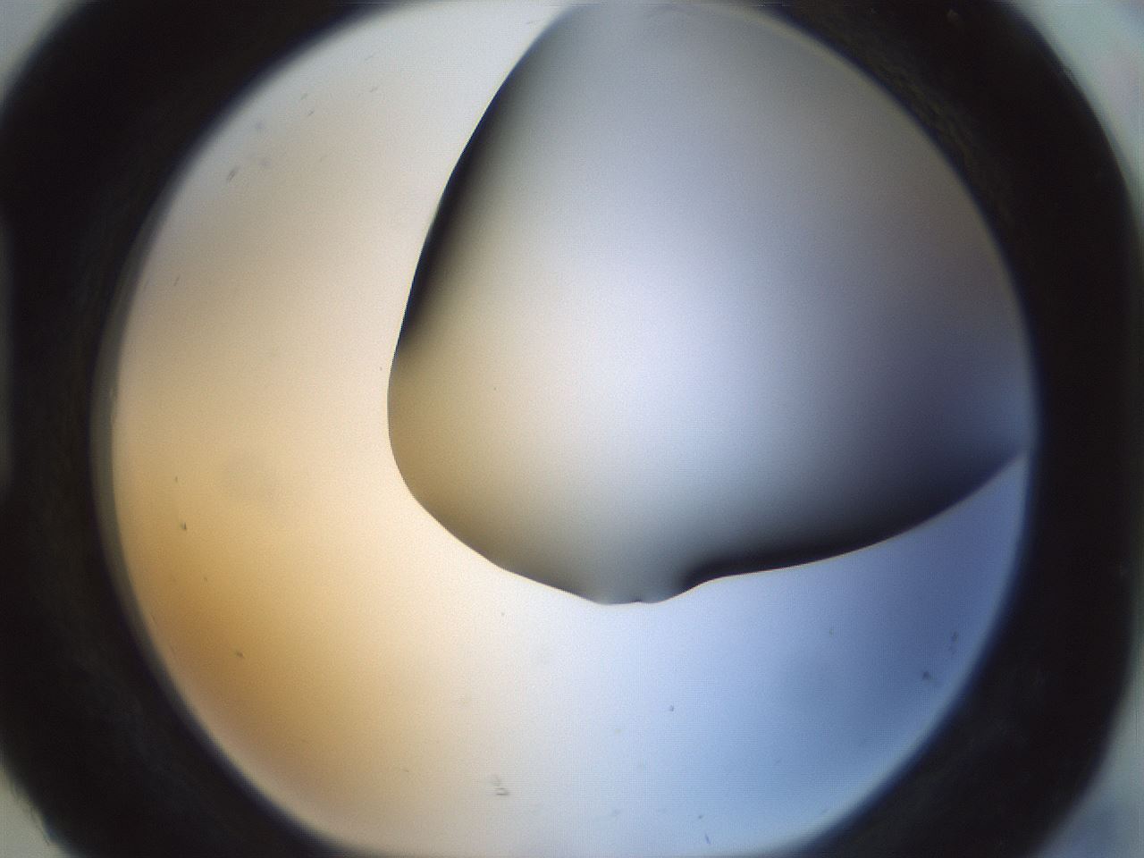 folderID299_plateID1299_batchID4267_wellNum92_profileID1_d1_r78675_ef.jpg