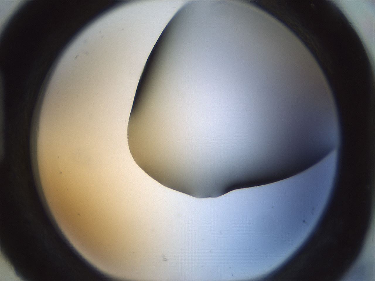 folderID299_plateID1299_batchID4304_wellNum92_profileID1_d1_r78675_ef.jpg