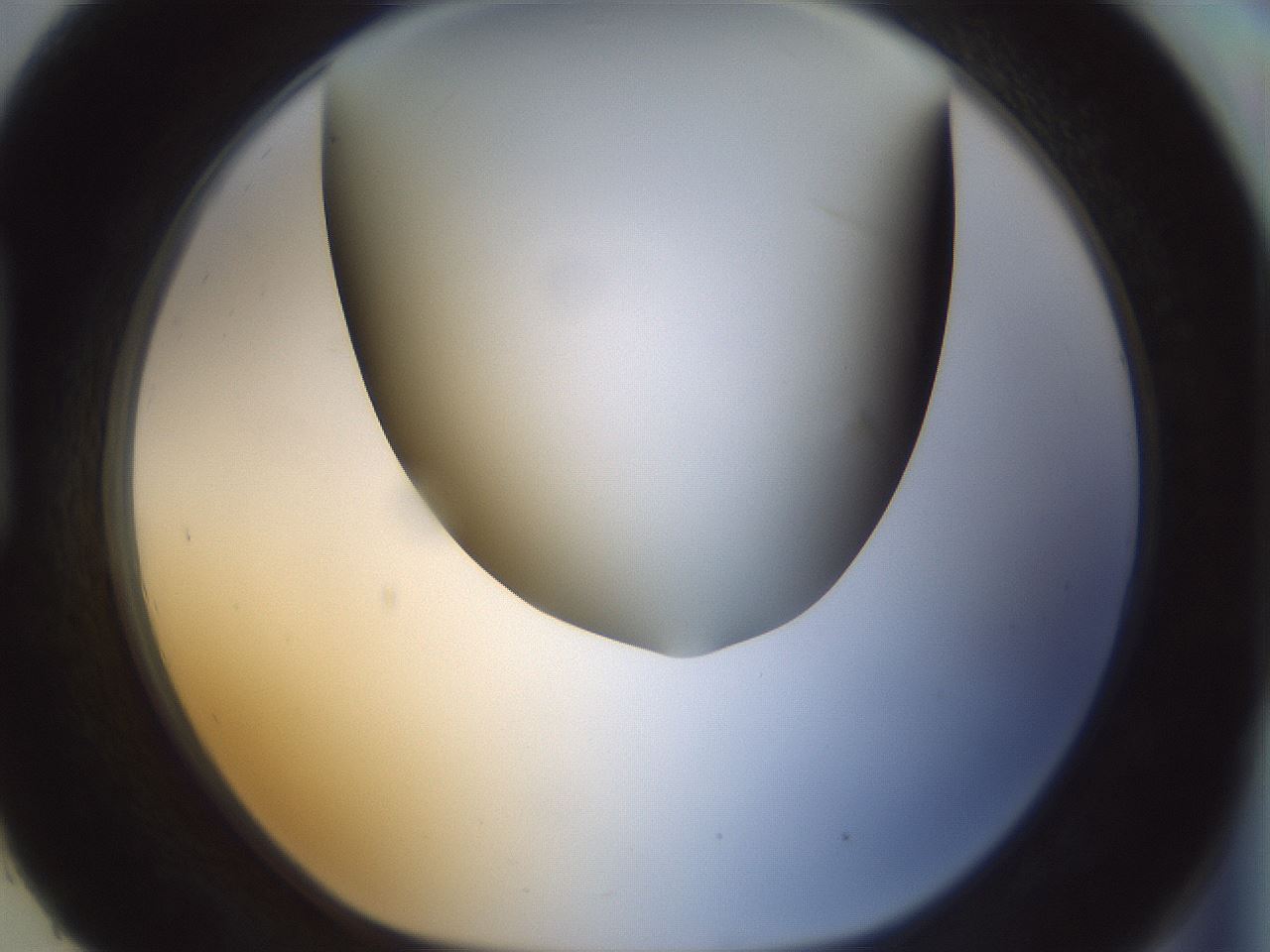 folderID299_plateID1299_batchID4304_wellNum93_profileID1_d1_r78676_ef.jpg