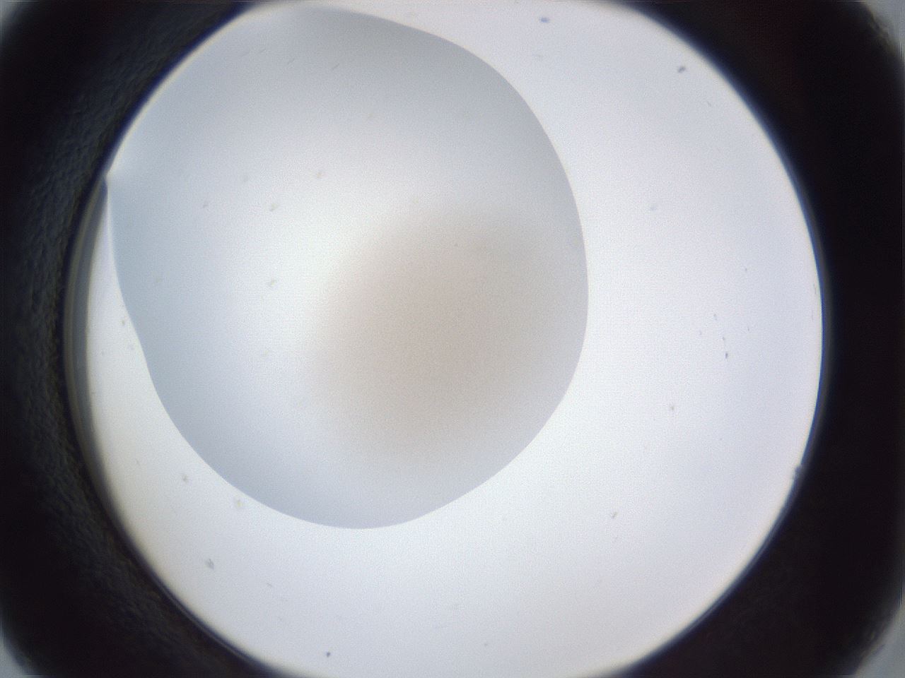 folderID29_plateID1029_batchID1998_wellNum5_profileID1_d2_r44141_ef.jpg