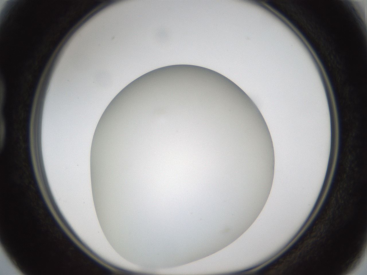 folderID302_plateID1302_batchID4262_wellNum15_profileID1_d1_r78310_ef.jpg