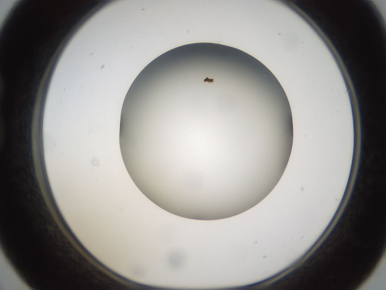 folderID302_plateID1302_batchID4262_wellNum21_profileID1_d1_r78316_ef.jpg