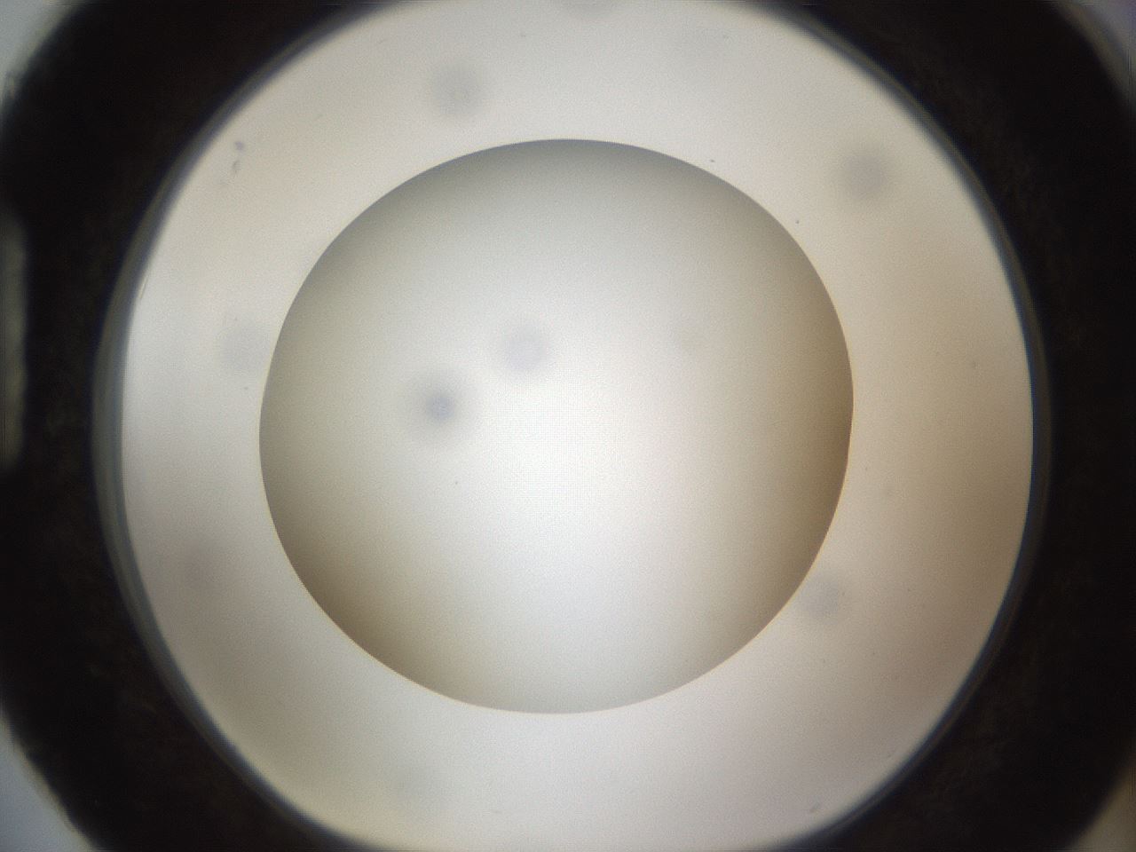 folderID302_plateID1302_batchID4262_wellNum88_profileID1_d1_r78383_ef.jpg