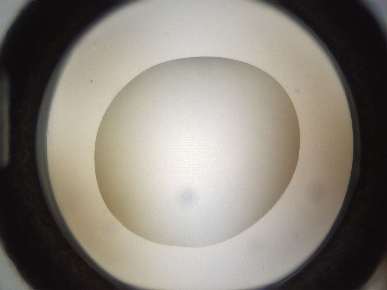 folderID302_plateID1302_batchID4262_wellNum87_profileID1_d1_r78382_ef.jpg