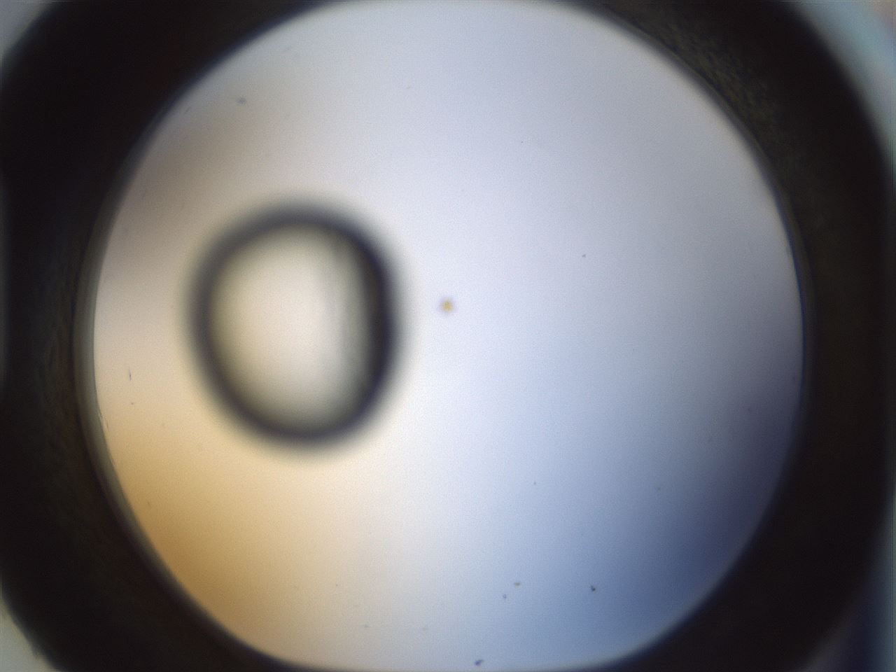 folderID168_plateID1168_batchID3177_wellNum93_profileID1_d1_r61755_ef.jpg
