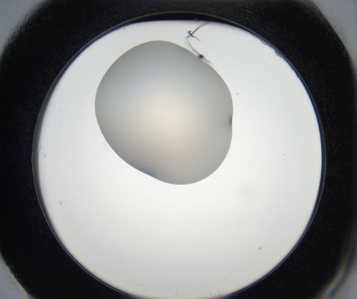folderID171_plateID2171_batchID9605_wellNum61_profileID1_d2_r145920_ef.jpg
