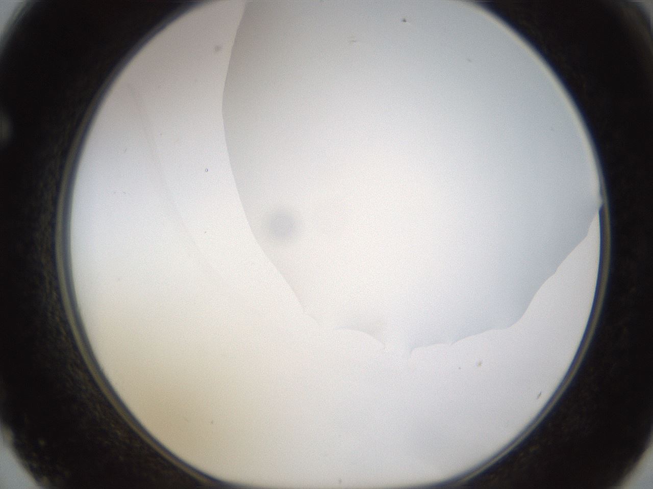 folderID175_plateID1175_batchID3226_wellNum62_profileID1_d1_r64316_ef.jpg