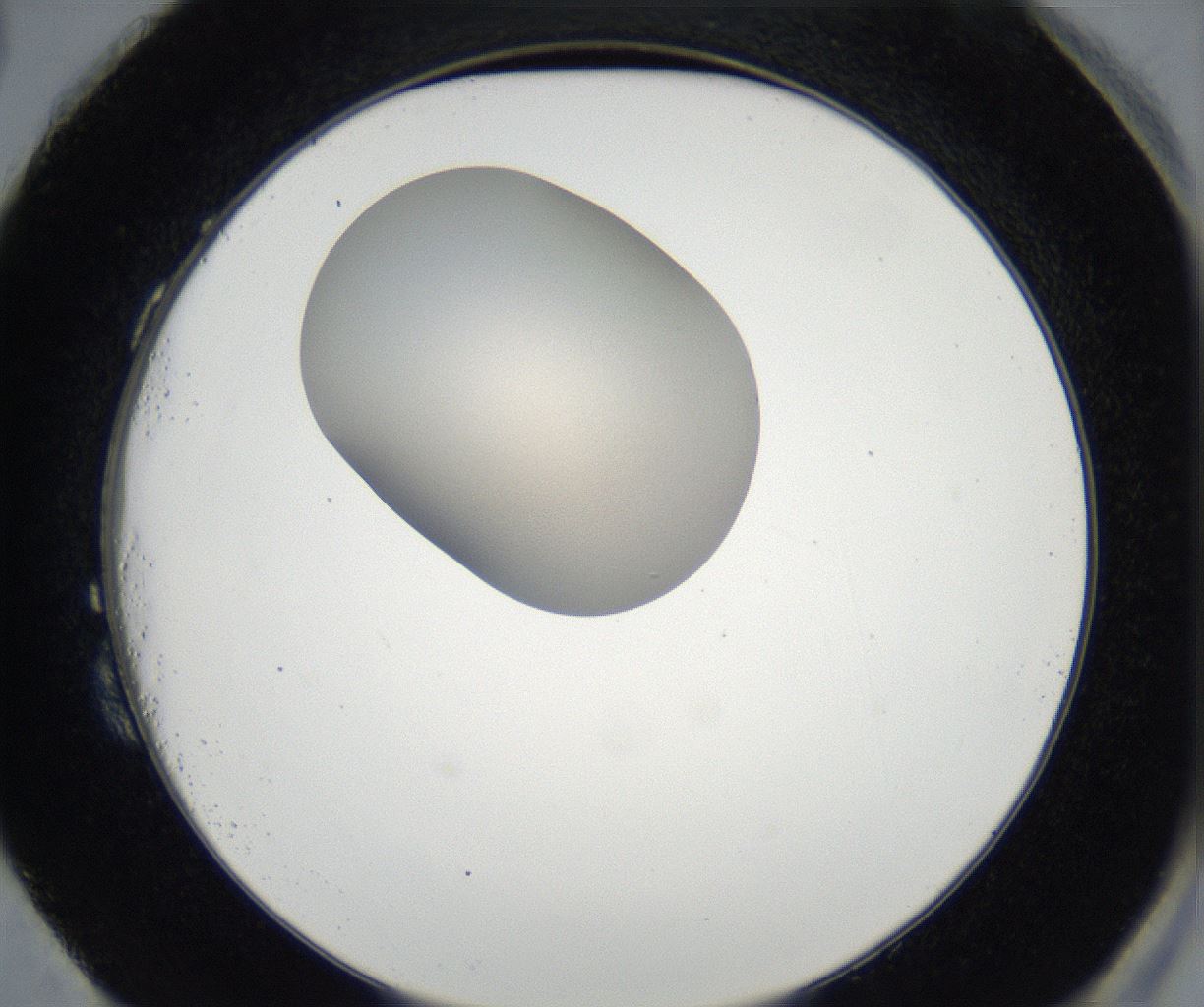 folderID175_plateID2175_batchID9608_wellNum87_profileID1_d2_r147124_ef.jpg