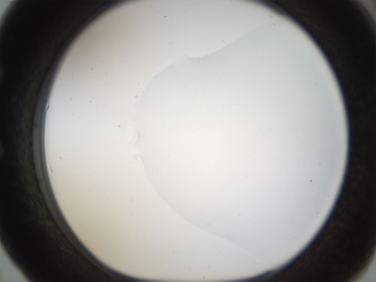 folderID176_plateID1176_batchID3247_wellNum53_profileID1_d1_r64691_ef.jpg