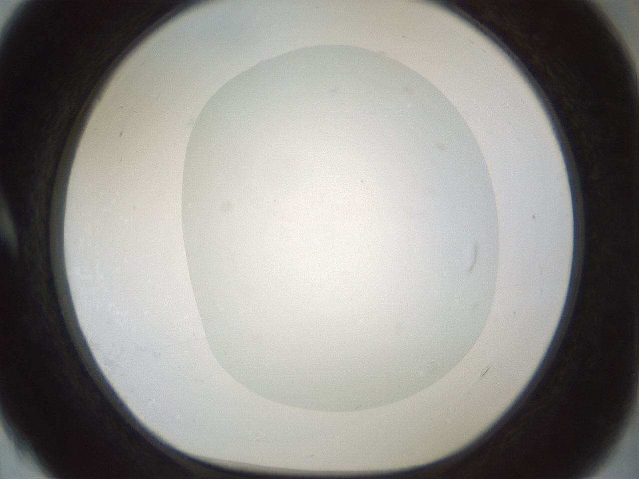 folderID179_plateID1179_batchID3362_wellNum4_profileID1_d1_r65410_ef.jpg