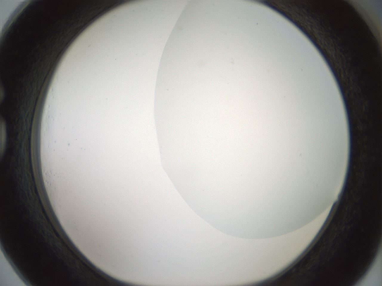 folderID179_plateID1179_batchID3362_wellNum73_profileID1_d1_r65479_ef.jpg