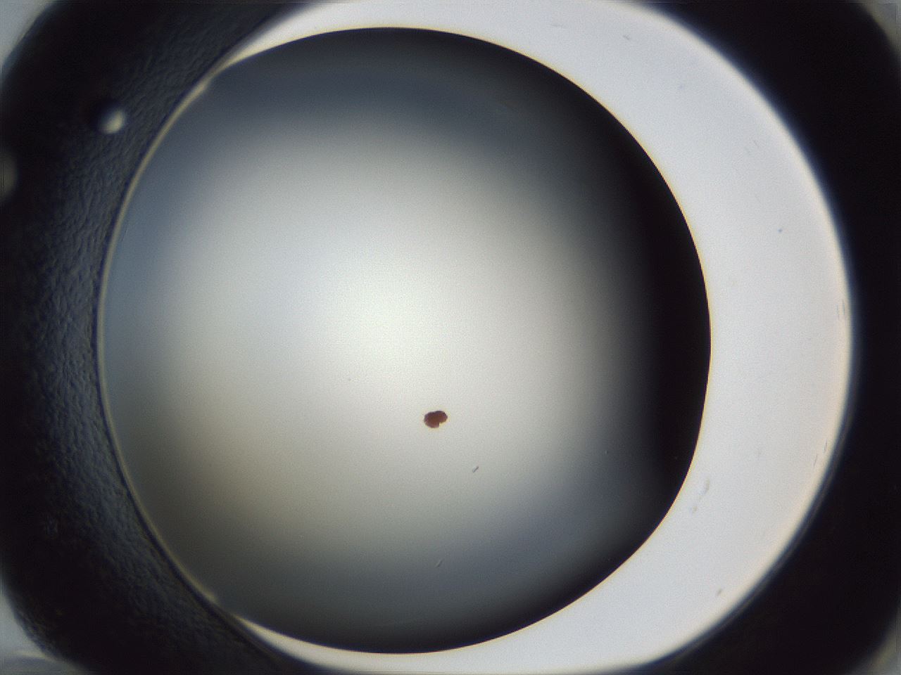 folderID17_plateID1017_batchID1900_wellNum72_profileID1_d1_r43243_ef.jpg