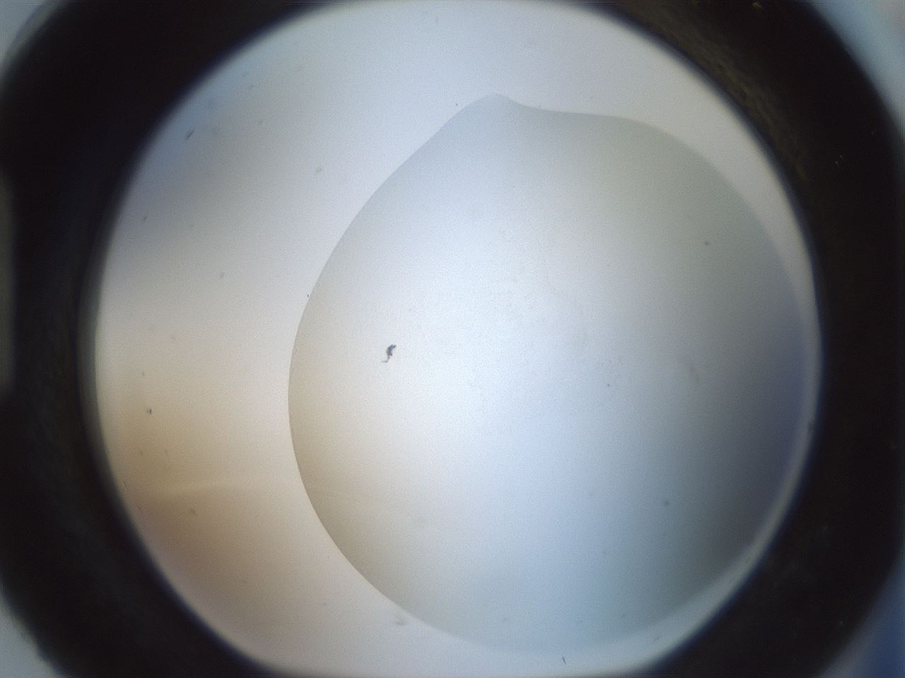 folderID180_plateID1180_batchID3360_wellNum92_profileID1_d1_r65306_ef.jpg