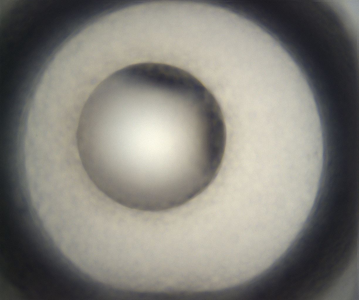 folderID304_plateID2304_batchID10856_wellNum70_profileID1_d1_r161875_ef.jpg