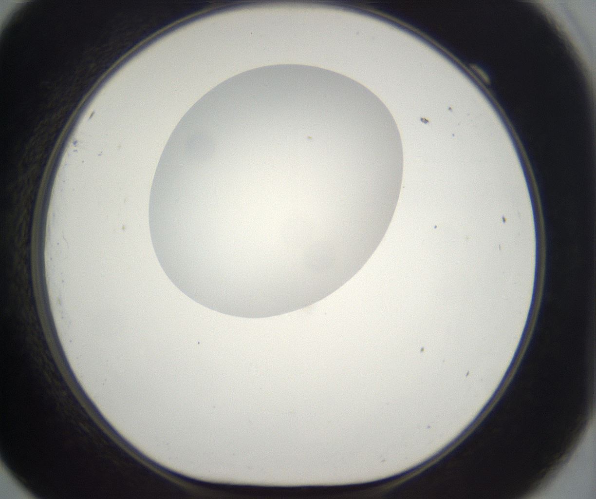 folderID304_plateID2304_batchID10856_wellNum69_profileID1_d1_r161874_ef.jpg