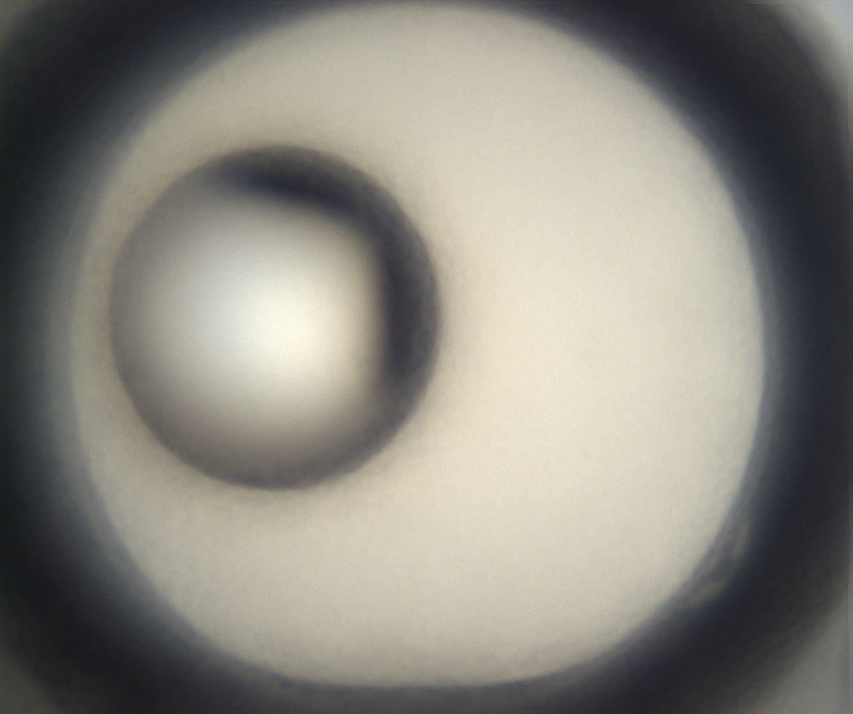 folderID304_plateID2304_batchID10856_wellNum82_profileID1_d1_r161887_ef.jpg