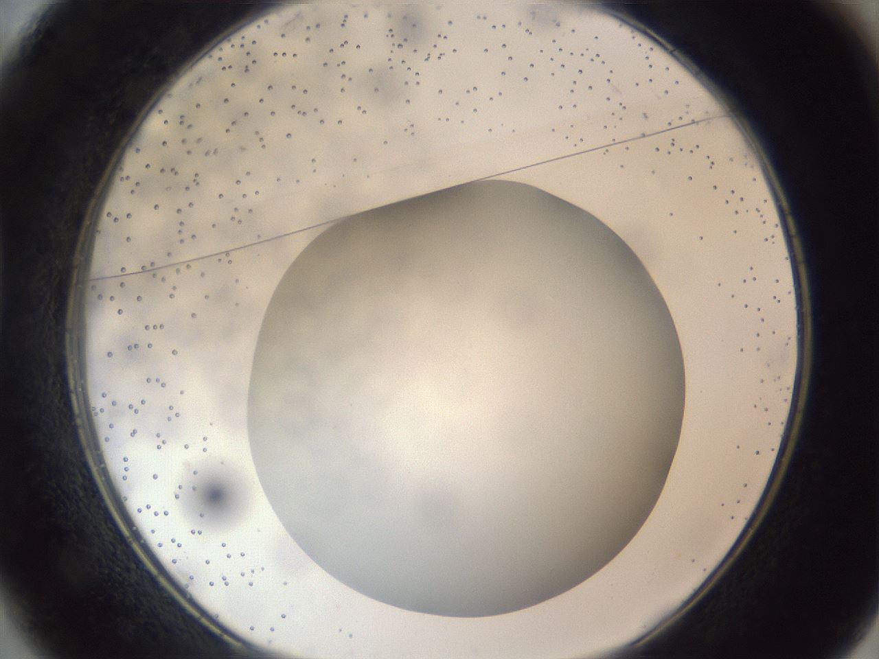 folderID305_plateID1305_batchID4293_wellNum37_profileID1_d1_r77852_ef.jpg