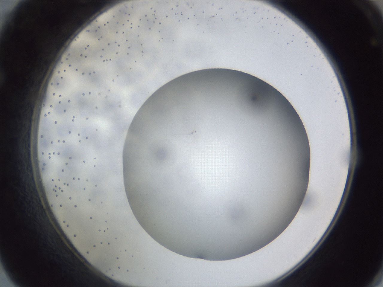 folderID305_plateID1305_batchID4293_wellNum62_profileID1_d1_r77877_ef.jpg