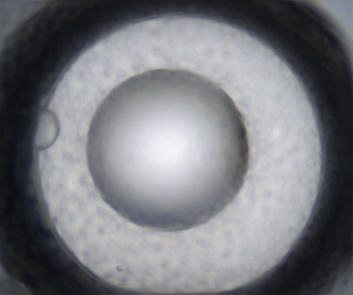 folderID305_plateID2305_batchID10850_wellNum70_profileID1_d1_r161299_ef.jpg