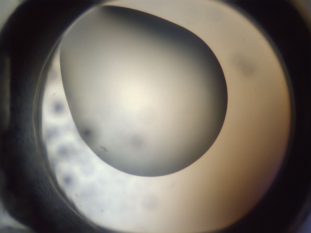 folderID306_plateID1306_batchID4296_wellNum96_profileID1_d1_r78199_ef.jpg