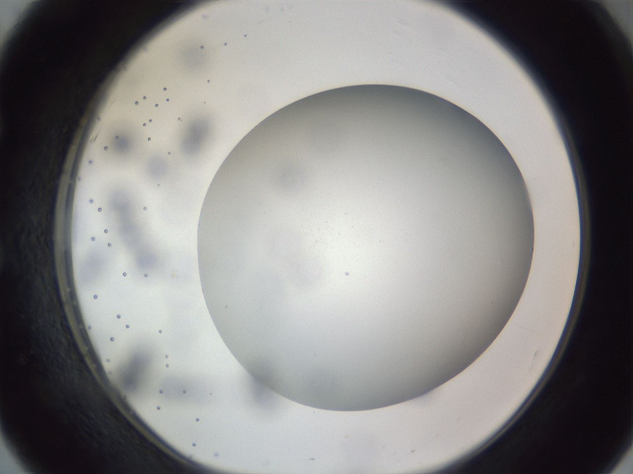 folderID308_plateID1308_batchID4308_wellNum51_profileID1_d1_r78922_ef.jpg