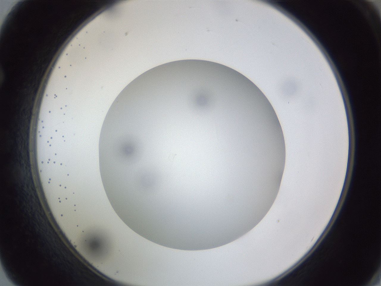 folderID308_plateID1308_batchID4308_wellNum62_profileID1_d1_r78933_ef.jpg