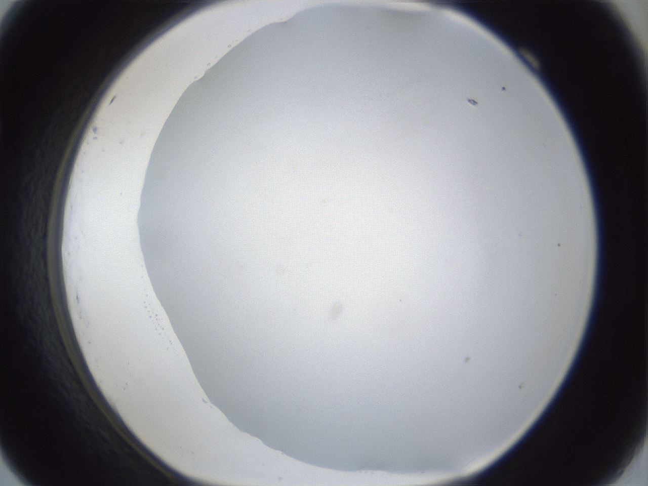 folderID30_plateID1030_batchID1981_wellNum69_profileID1_d1_r44844_ef.jpg