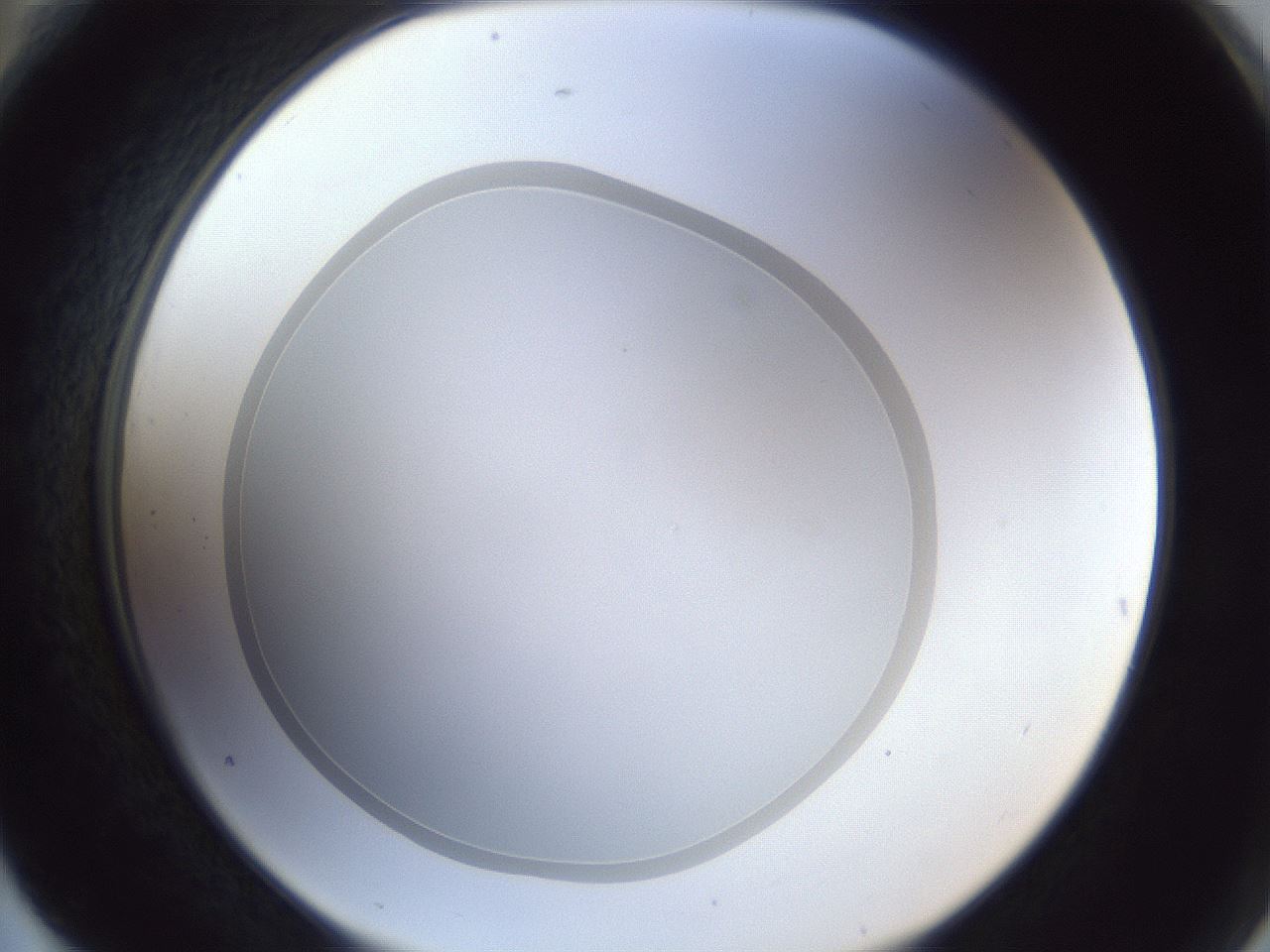folderID31_plateID1031_batchID1982_wellNum76_profileID1_d2_r44475_ef.jpg