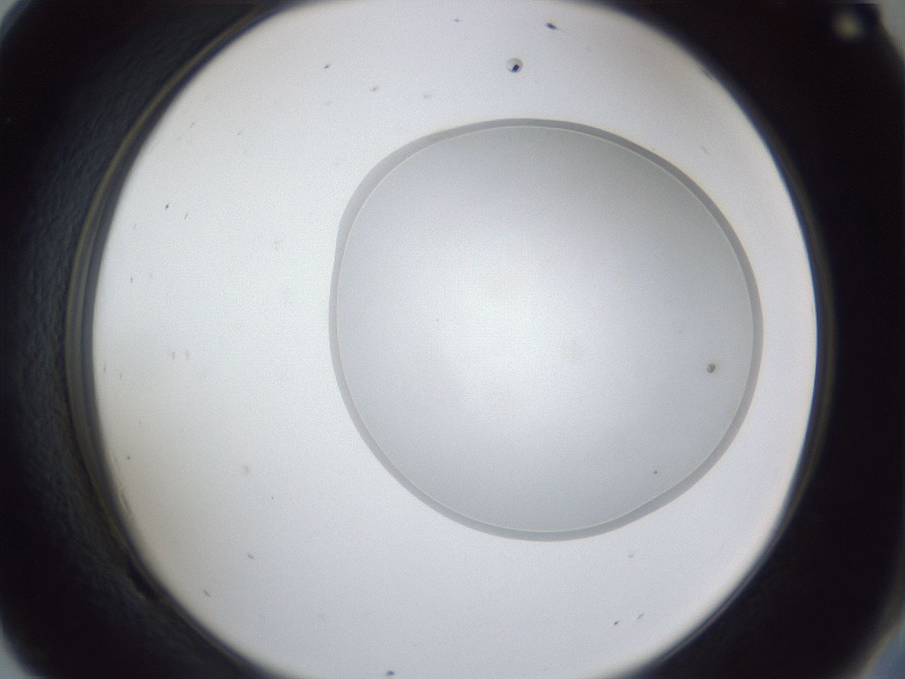 folderID31_plateID1031_batchID1999_wellNum69_profileID1_d2_r44461_ef.jpg