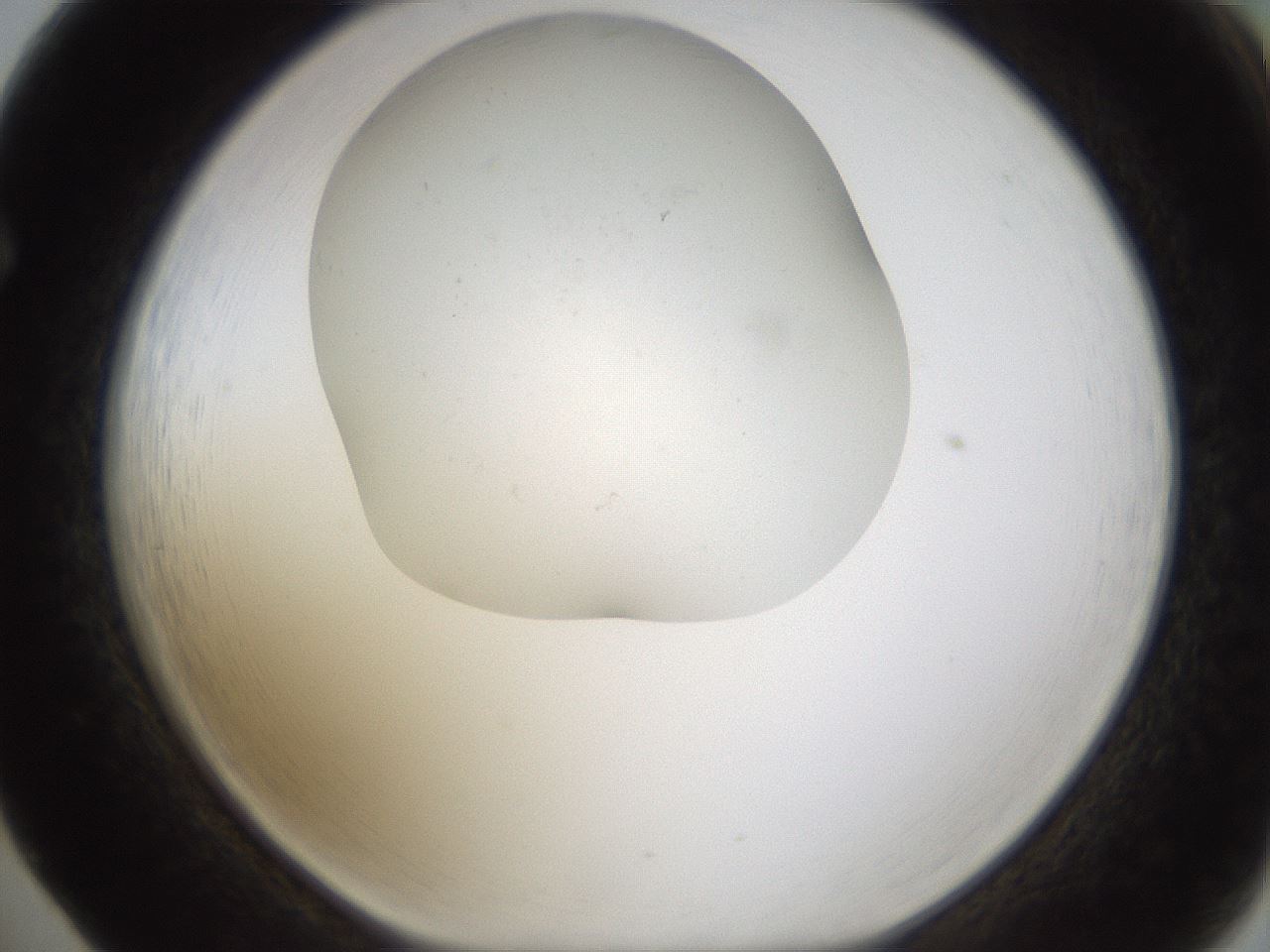 folderID320_plateID1320_batchID4375_wellNum65_profileID1_d1_r79224_ef.jpg