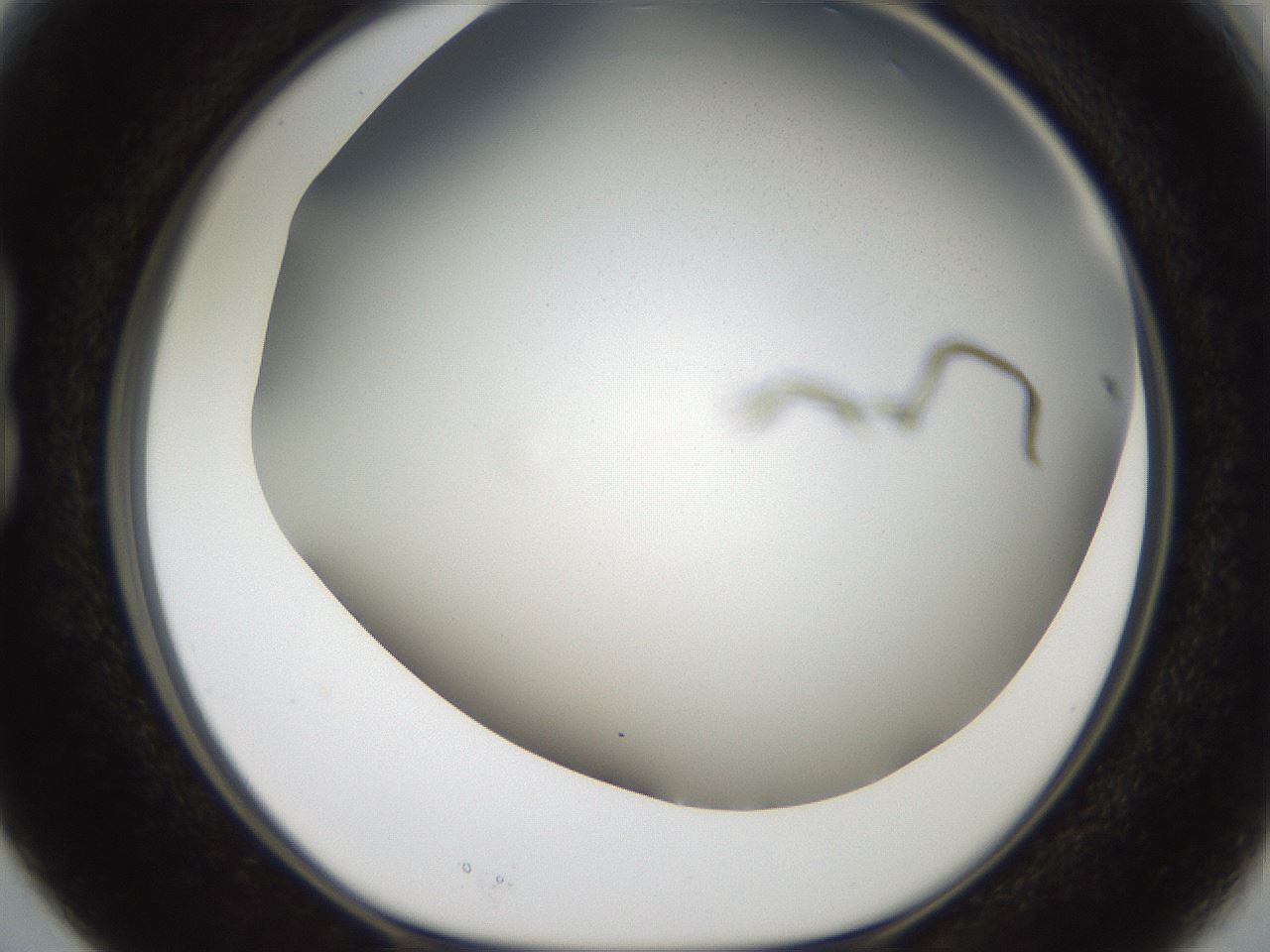 folderID321_plateID2321_batchID10963_wellNum15_profileID1_d1_r163377_ef.jpg