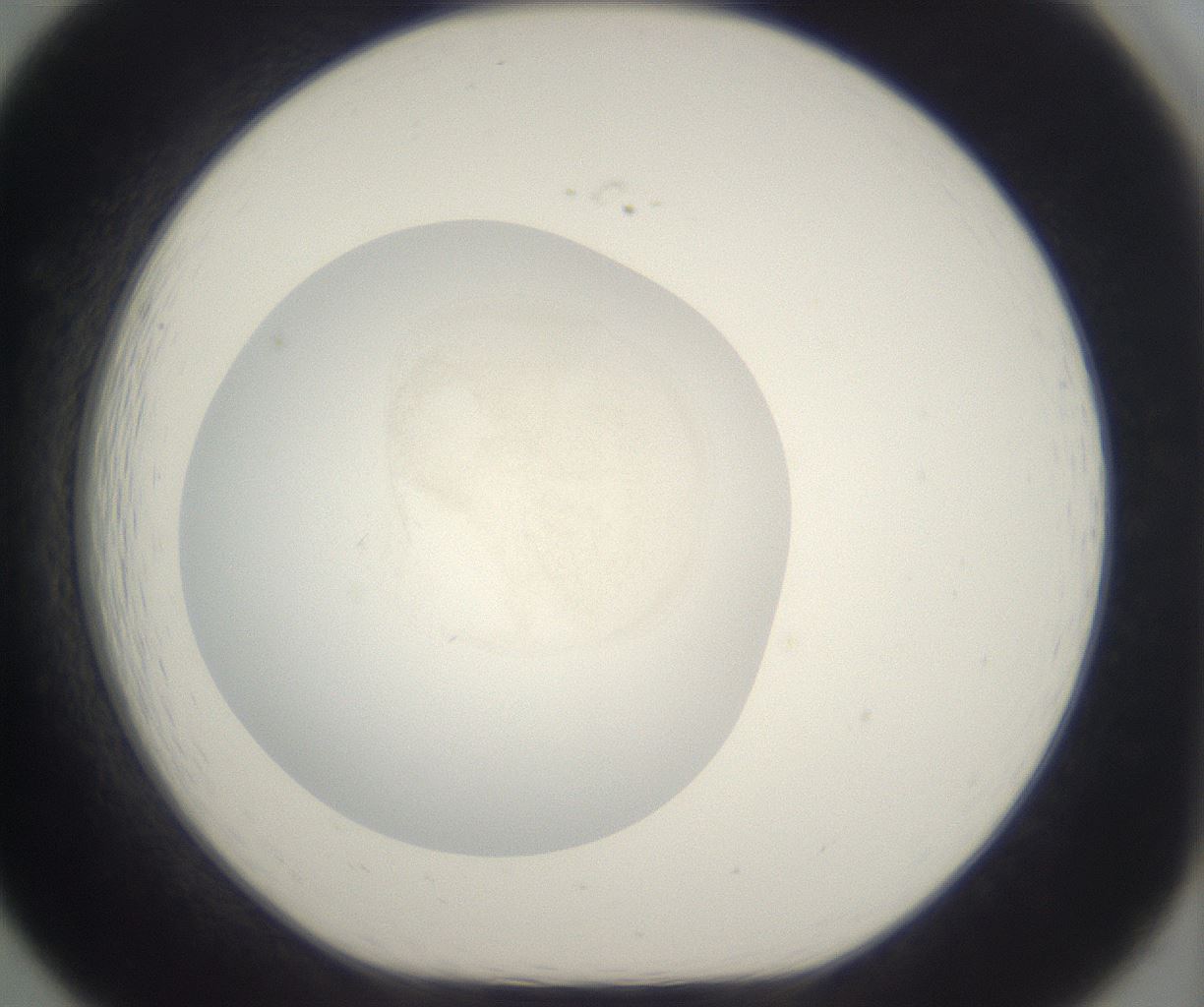 folderID331_plateID2331_batchID11001_wellNum19_profileID1_d1_r164533_ef.jpg