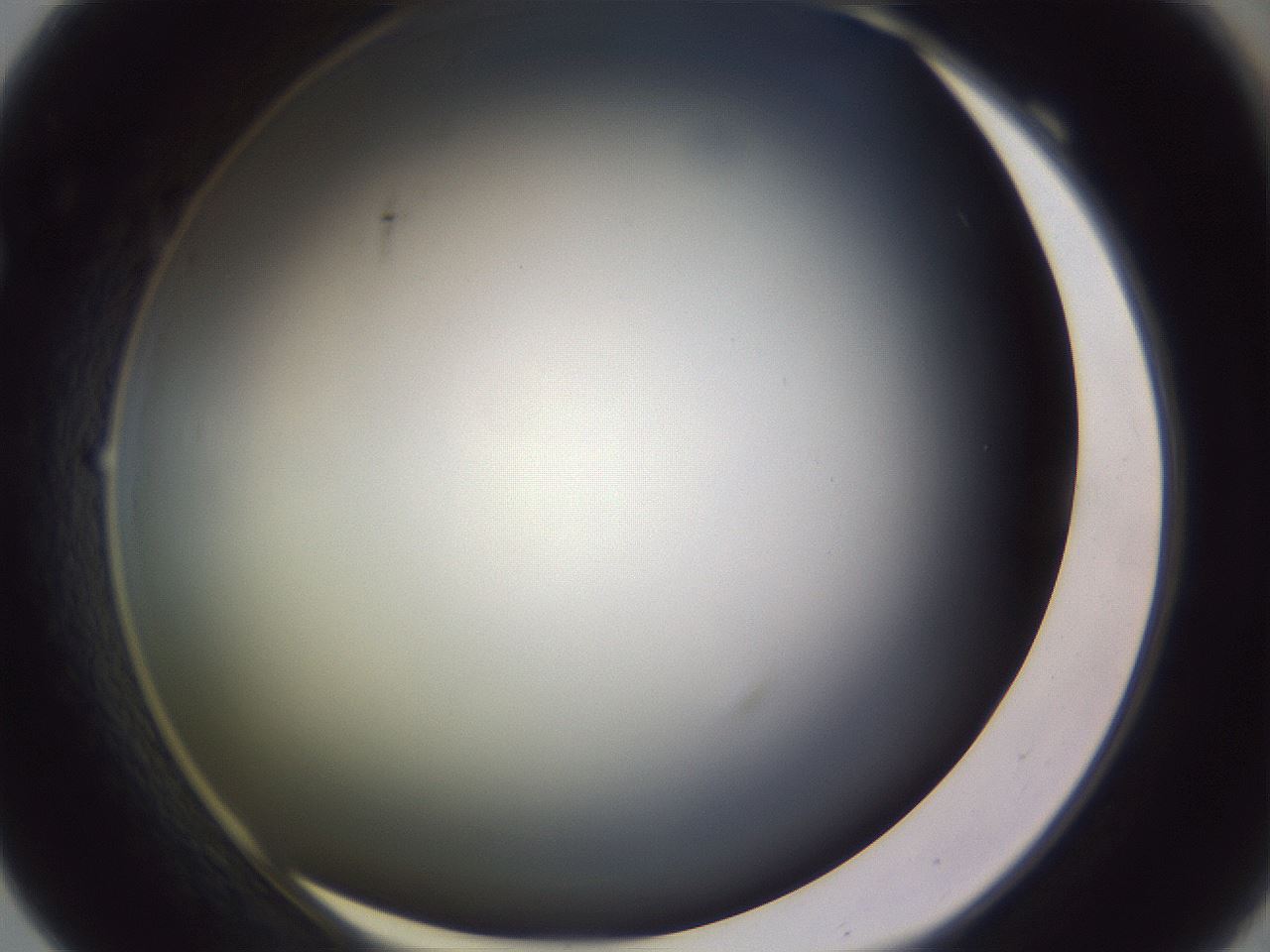 folderID351_plateID1351_batchID4706_wellNum69_profileID1_d1_r81584_ef.jpg