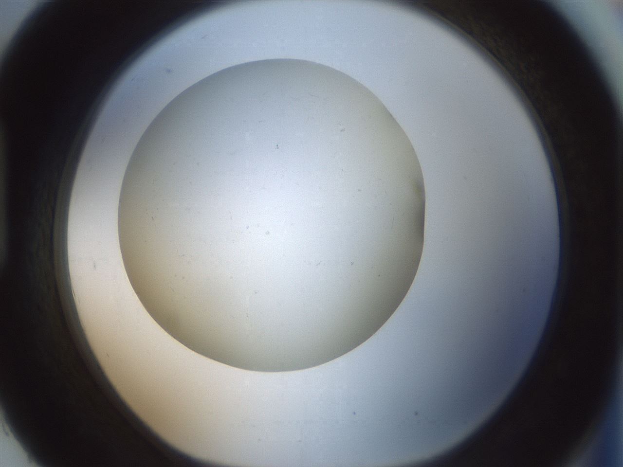 folderID370_plateID1370_batchID4736_wellNum93_profileID1_d1_r83628_ef.jpg