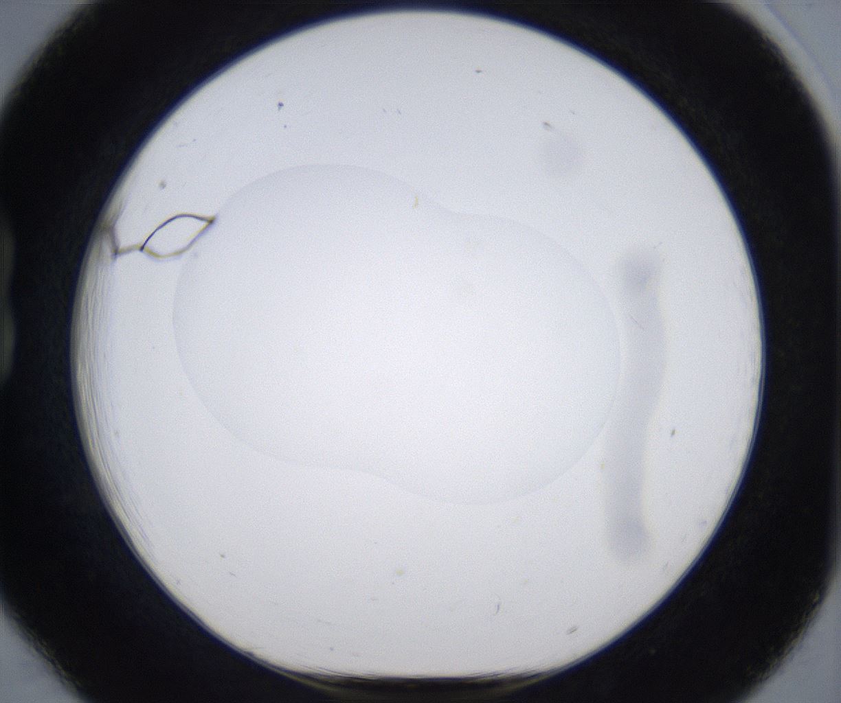 folderID374_plateID2374_batchID11190_wellNum18_profileID1_d1_r175188_ef.jpg