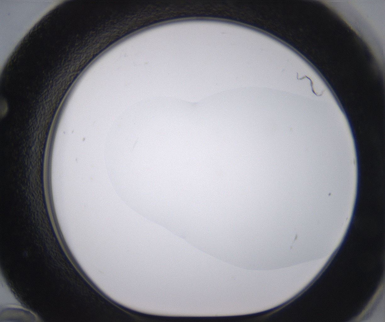 folderID379_plateID2379_batchID11224_wellNum72_profileID1_d1_r175434_ef.jpg