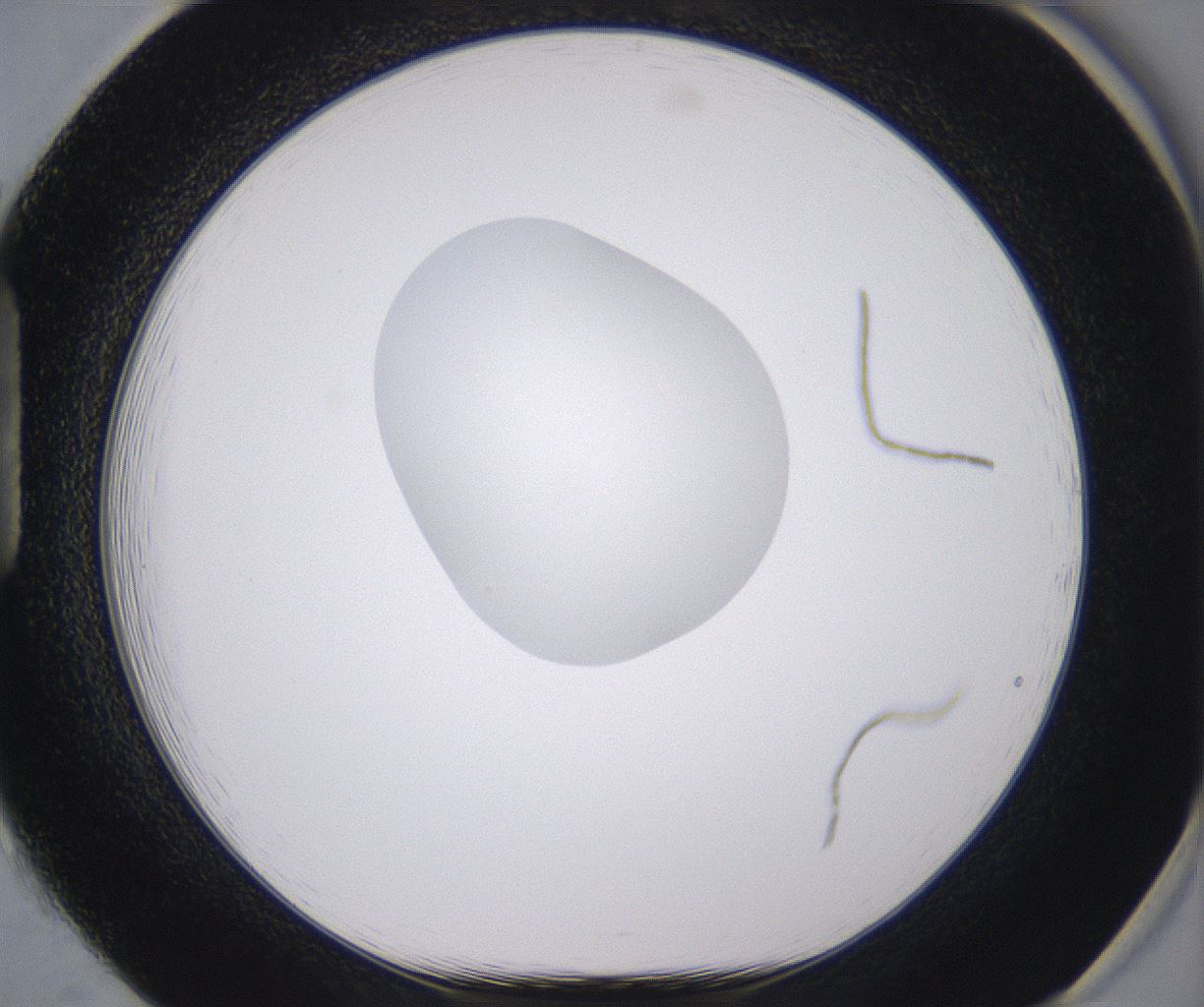 folderID379_plateID2379_batchID11224_wellNum85_profileID1_d1_r175447_ef.jpg