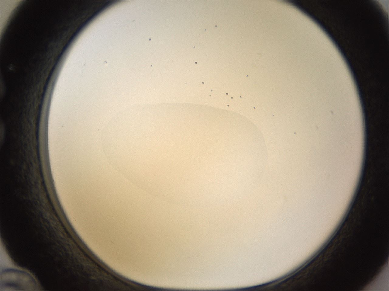 folderID398_plateID1398_batchID5055_wellNum36_profileID1_d1_r85397_ef.jpg
