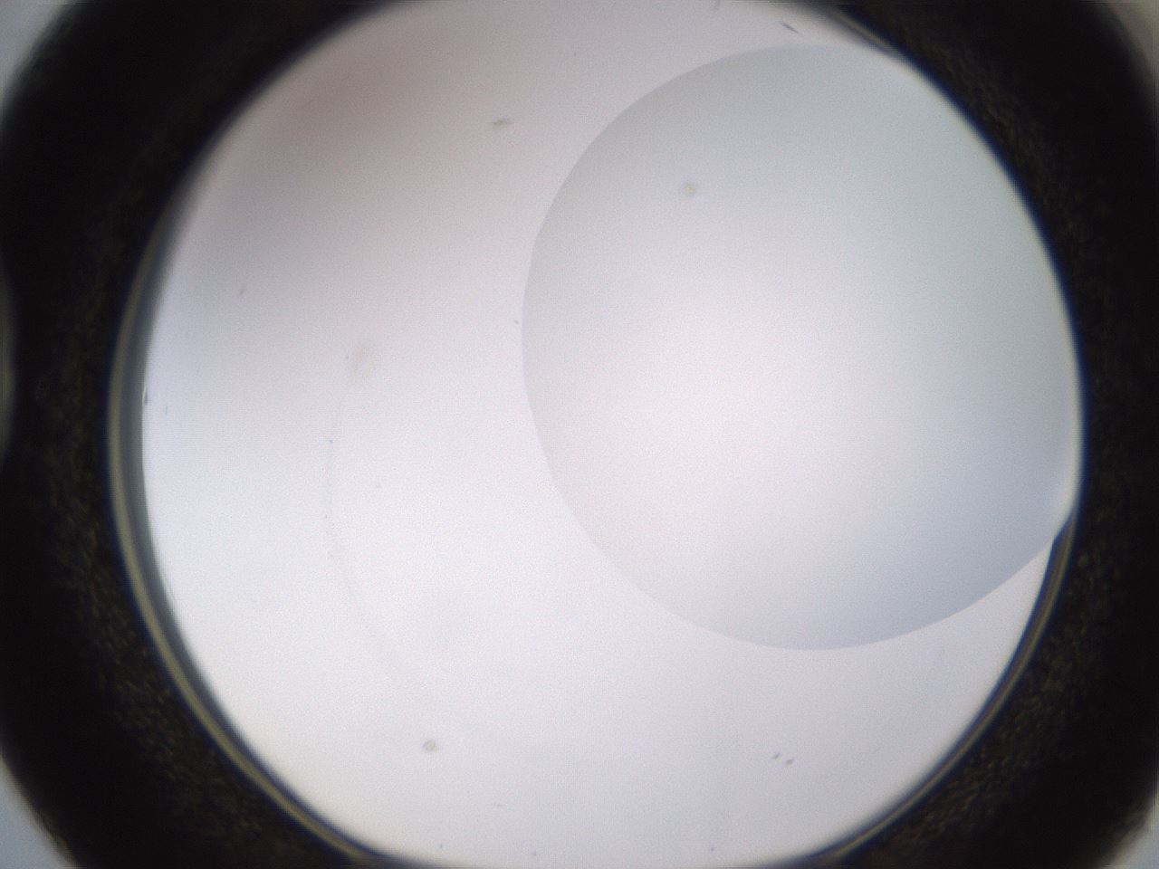 folderID398_plateID1398_batchID5055_wellNum38_profileID1_d1_r85399_ef.jpg