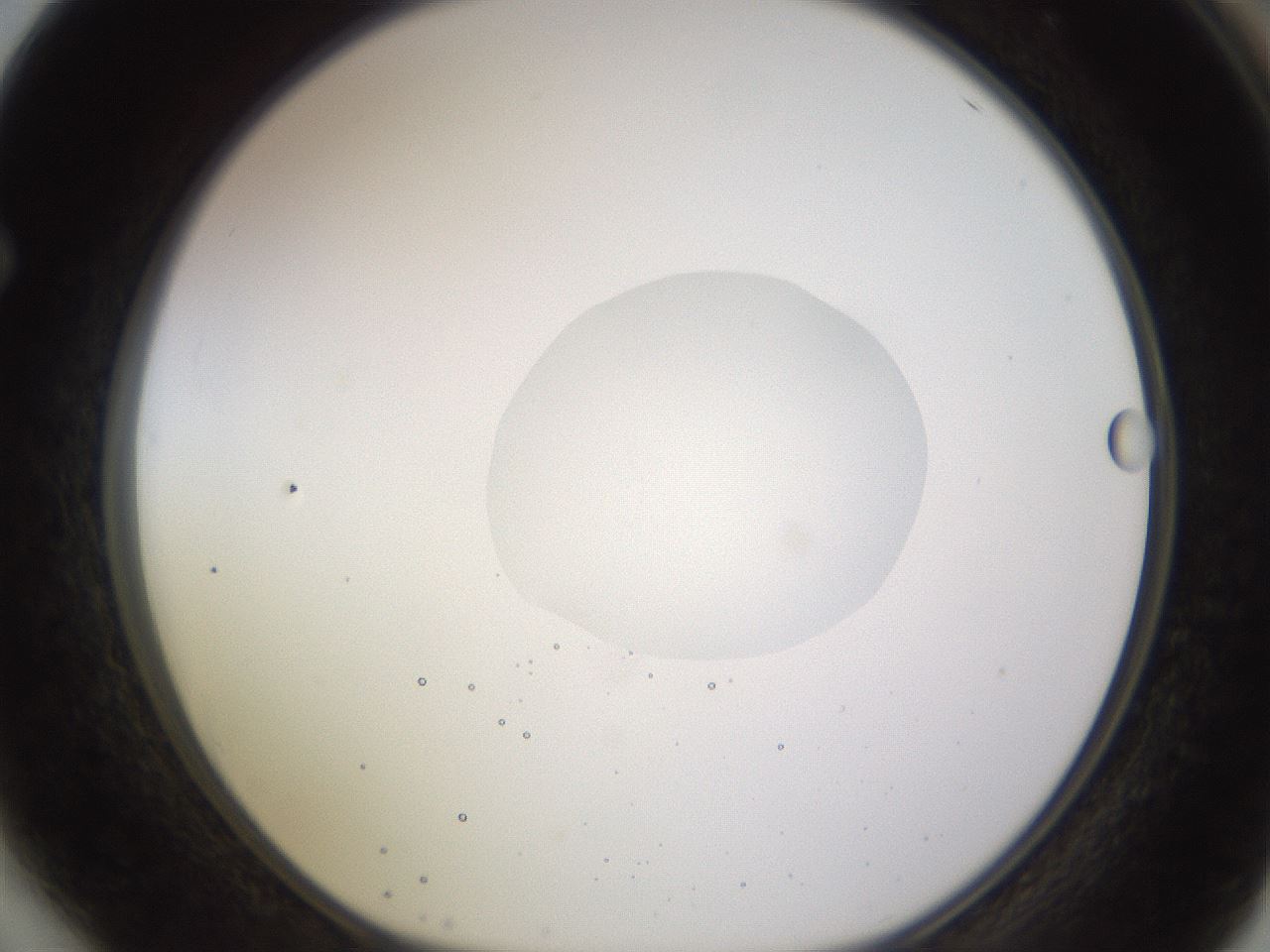 folderID398_plateID1398_batchID5055_wellNum64_profileID1_d1_r85425_ef.jpg