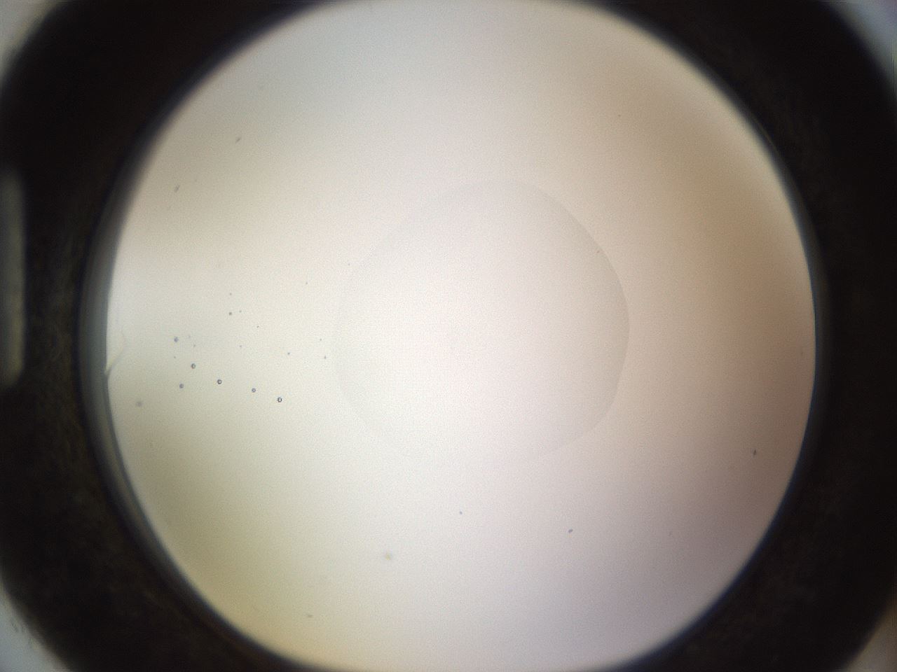 folderID398_plateID1398_batchID5055_wellNum90_profileID1_d1_r85451_ef.jpg