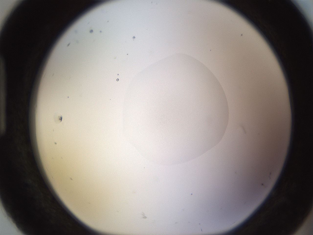 folderID398_plateID1398_batchID5055_wellNum92_profileID1_d1_r85453_ef.jpg