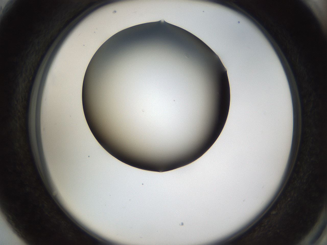 folderID39_plateID1039_batchID2095_wellNum89_profileID1_d2_r45369_ef.jpg