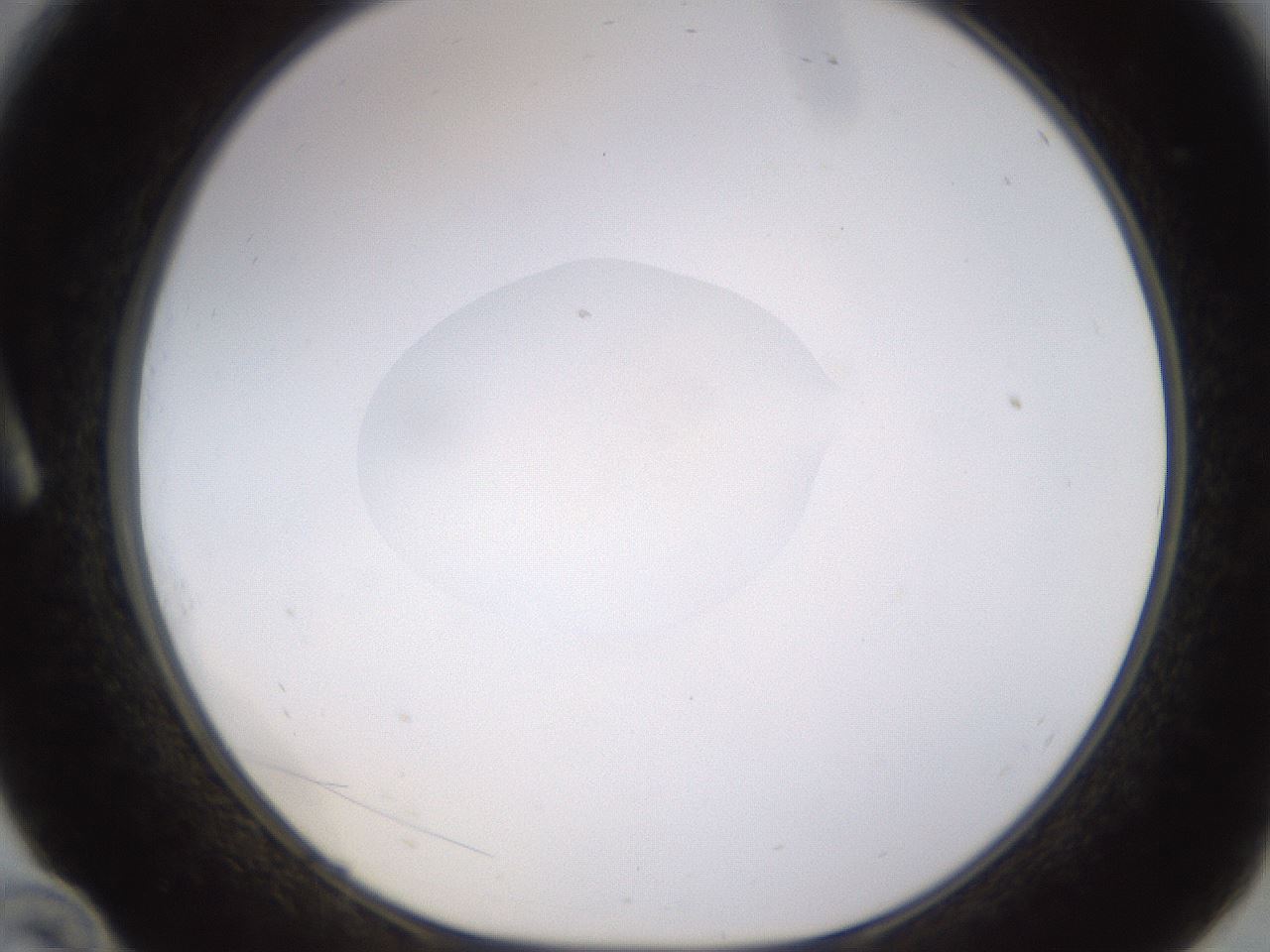 folderID401_plateID1401_batchID5050_wellNum10_profileID1_d1_r84987_ef.jpg