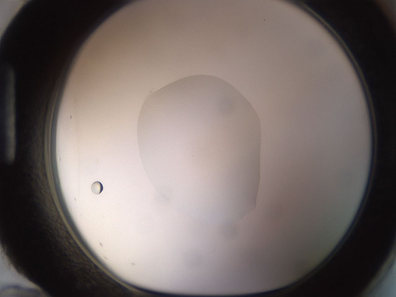 folderID402_plateID1402_batchID5054_wellNum96_profileID1_d1_r85361_ef.jpg