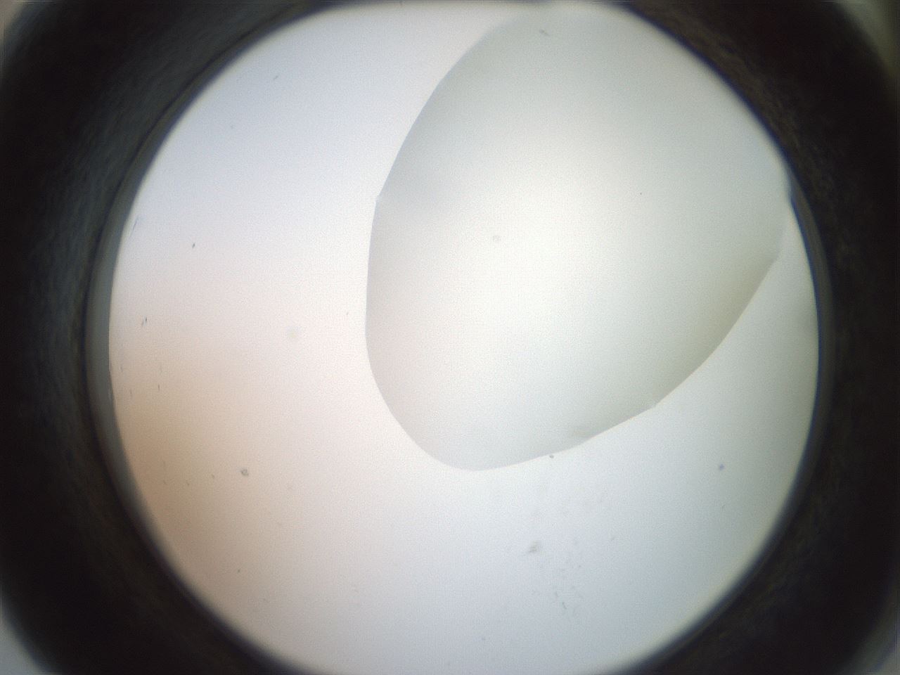 folderID402_plateID2402_batchID11611_wellNum79_profileID1_d2_r177920_ef.jpg