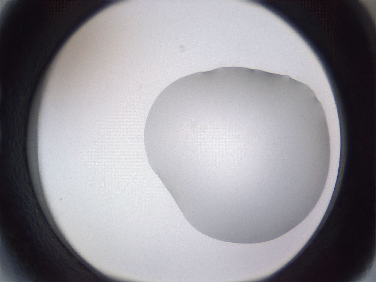 folderID405_plateID2405_batchID11613_wellNum27_profileID1_d1_r178199_ef.jpg